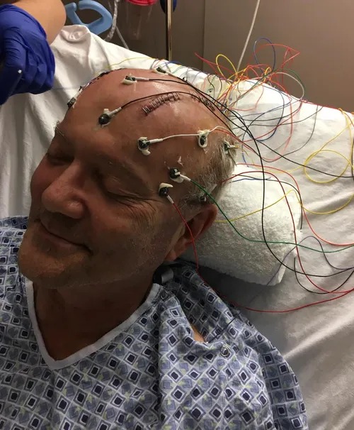 Brain and Skull Base Surgery